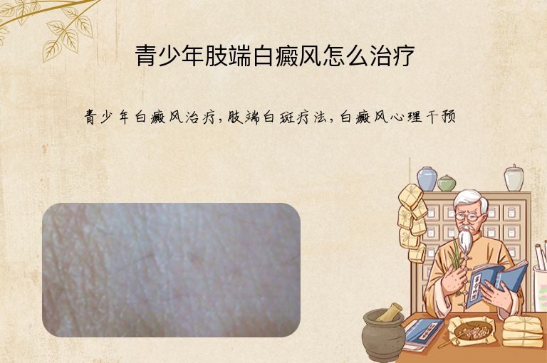 青少年肢端白癜风怎么治疗”