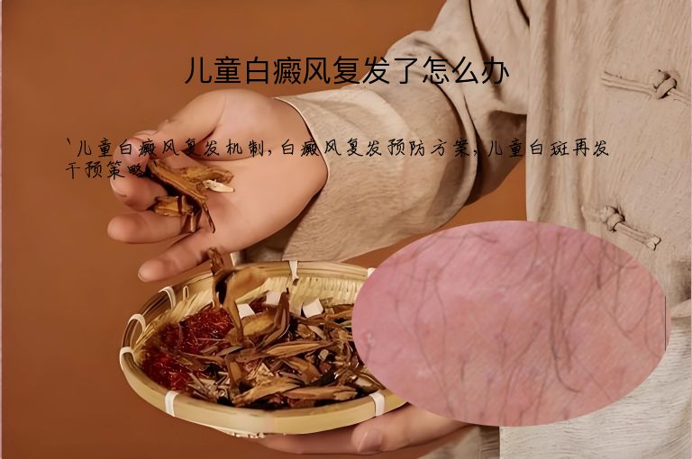 儿童白癜风复发了怎么办”
