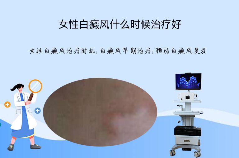 女性白癜风什么时候治疗好”