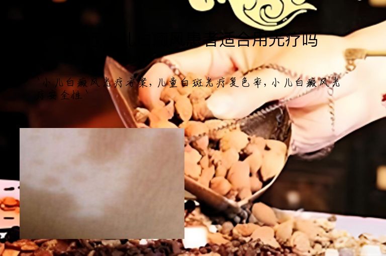 治疗小儿白癜风患者适合用光疗吗