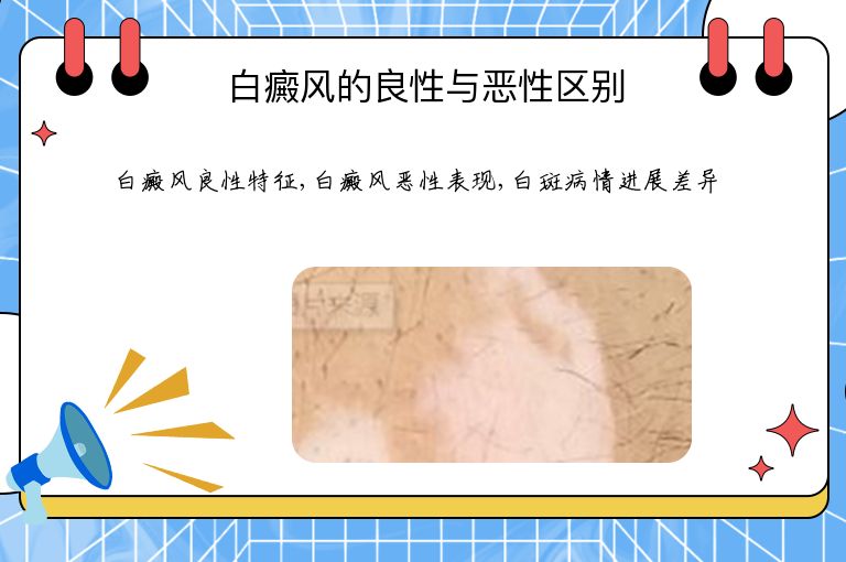 https://www.bdfsjzyy.com/d/file/p/45a3fd7d8ba034288f3f6600d150229f.jpeg