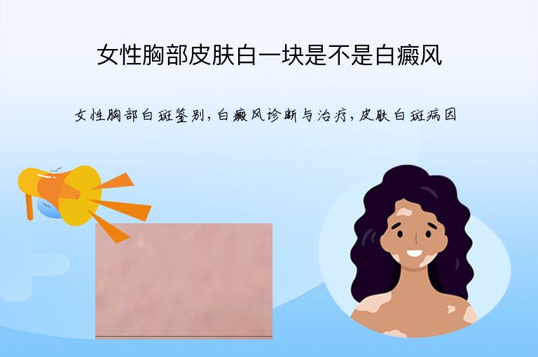 女性胸部皮肤白一块是不是白癜风”
