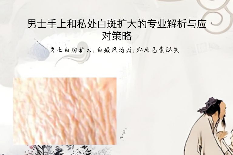 男士手上和私处白斑扩大的专业解析与应对策略”