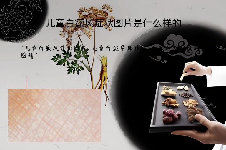 儿童白癜风症状图片是什么样的”