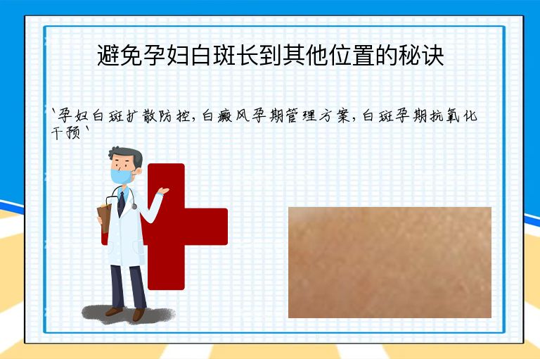 避免孕妇白斑长到其他位置的秘诀