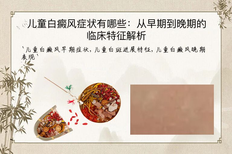 儿童白癜风症状有哪些：从早期到晚期的临床特征解析