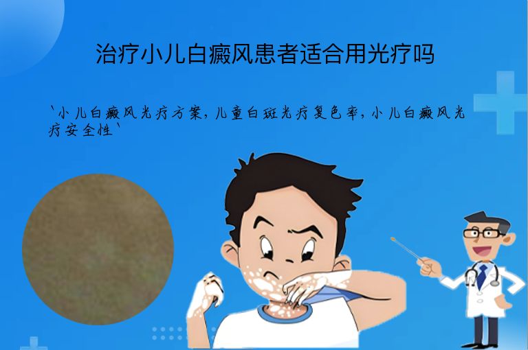 治疗小儿白癜风患者适合用光疗吗