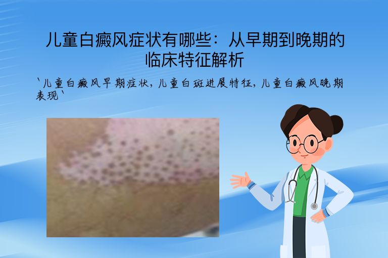 儿童白癜风症状有哪些:从早期到晚期的临床特征解析