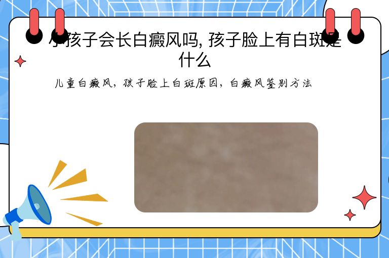 https://www.bdfsjzyy.com/d/file/p/82cde398a8a287545a4c2d1b223c4eee.jpeg
