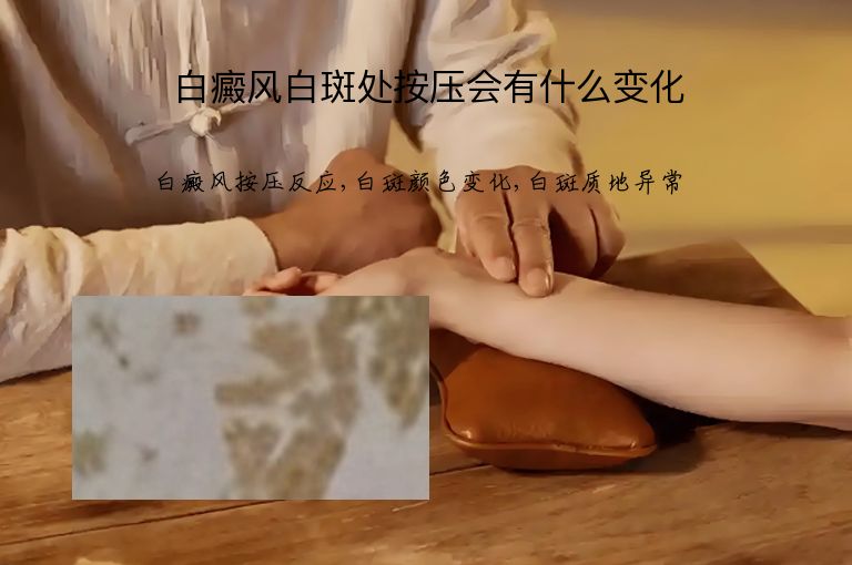 白癜风白斑处按压会有什么变化”
