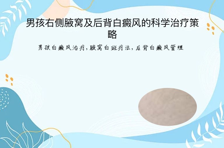 男孩右侧腋窝及后背白癜风的科学治疗策略”