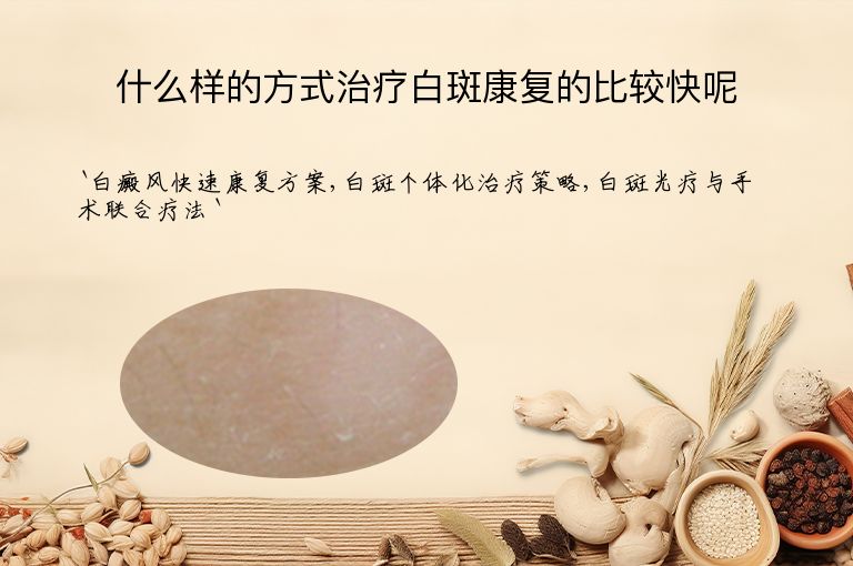什么样的方式治疗白斑康复的比较快呢