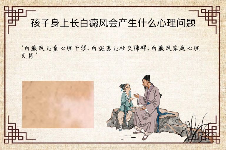 孩子身上长白癜风会产生什么心理问题”