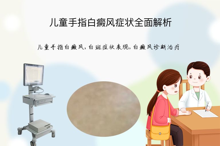 儿童手指白癜风症状全面解析”