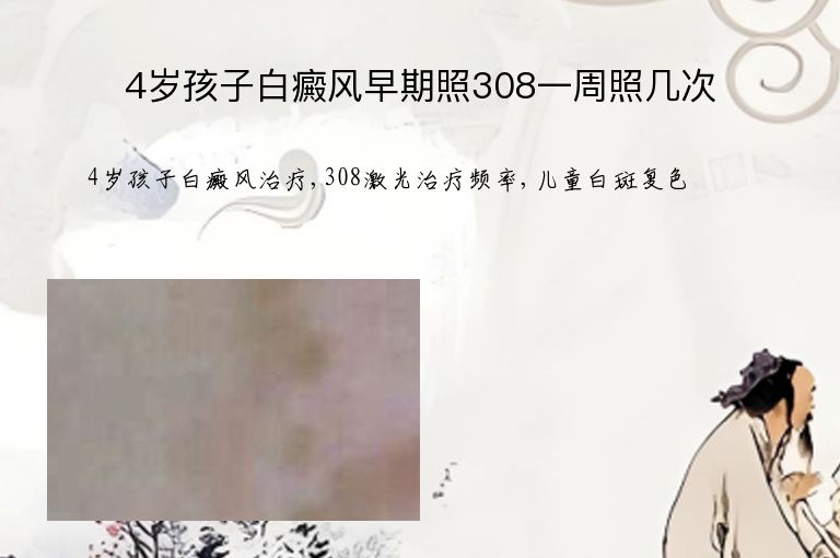 4岁孩子白癜风早期照308一周照几次”