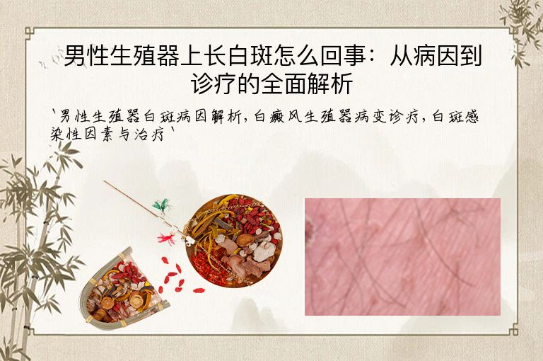 男性生殖器上长白斑怎么回事:从病因到诊疗的全面解析
