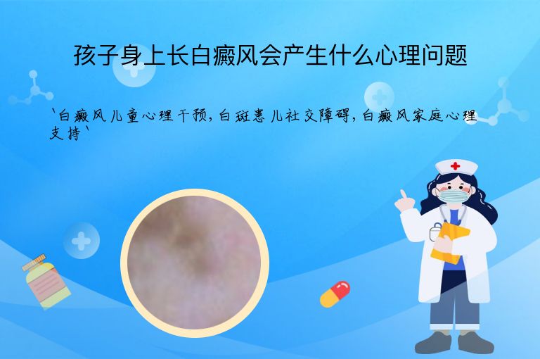 孩子身上长白癜风会产生什么心理问题”