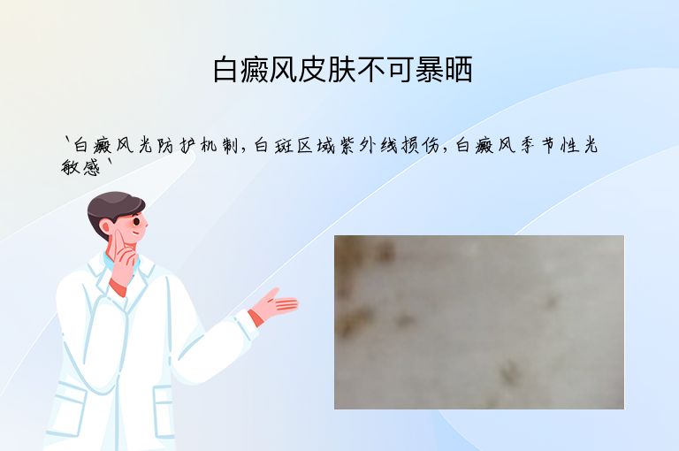 白癜风皮肤不可暴晒