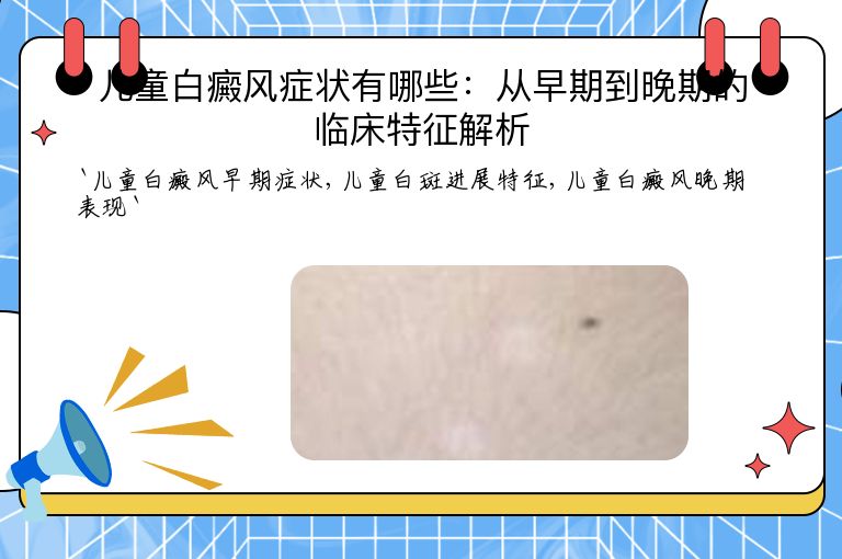儿童白癜风症状有哪些:从早期到晚期的临床特征解析