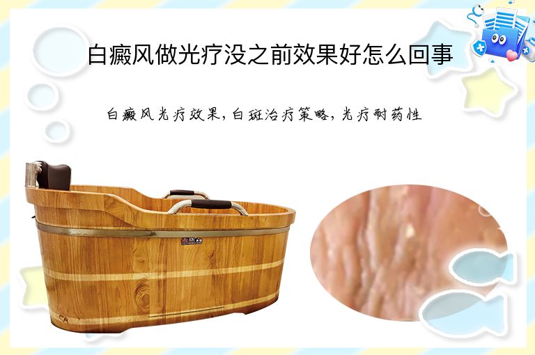 白癜风做光疗没之前效果好怎么回事”