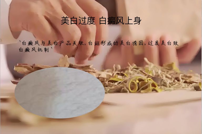 https://www.bdfsjzyy.com/d/file/p/70b6cc7e752f495780dbeca5f5264792.jpeg