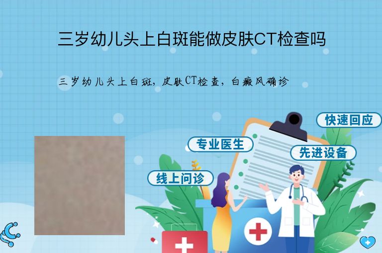 https://www.bdfsjzyy.com/d/file/p/d94482f14984edcb25893a78e82cd175.jpeg