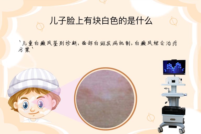 儿子脸上有块白色的是什么”