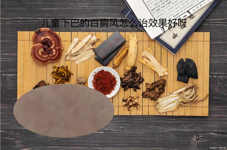 儿童下巴的白癜风怎么治效果好呀”