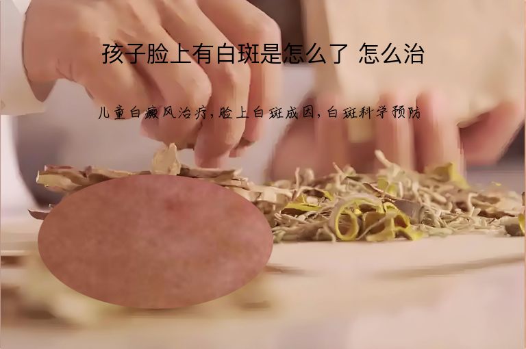 孩子脸上有白斑是怎么了 怎么治”