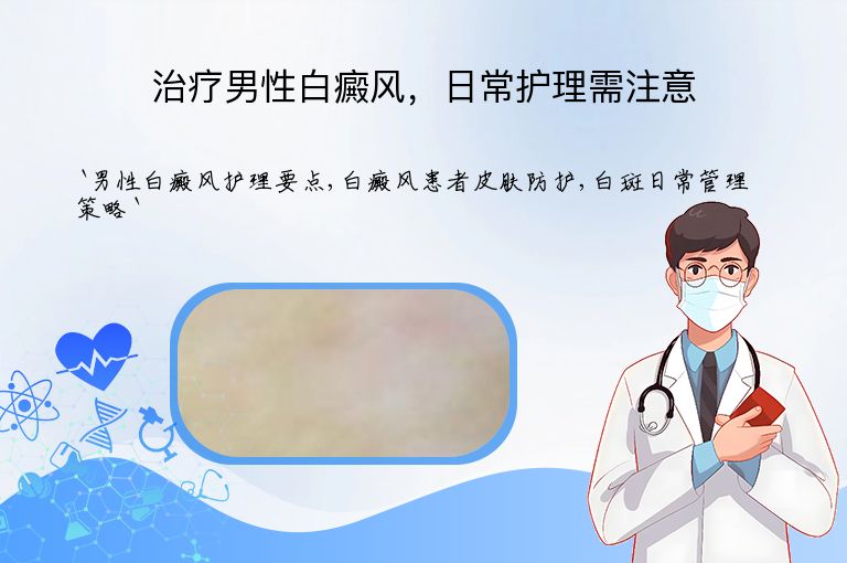 治疗男性白癜风,日常护理需注意