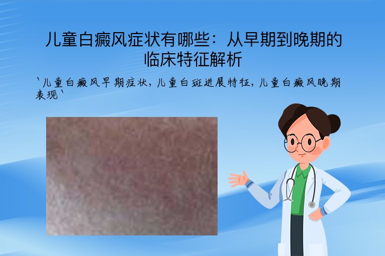 儿童白癜风症状有哪些：从早期到晚期的临床特征解析