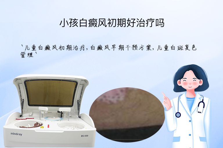 小孩白癜风初期好治疗吗