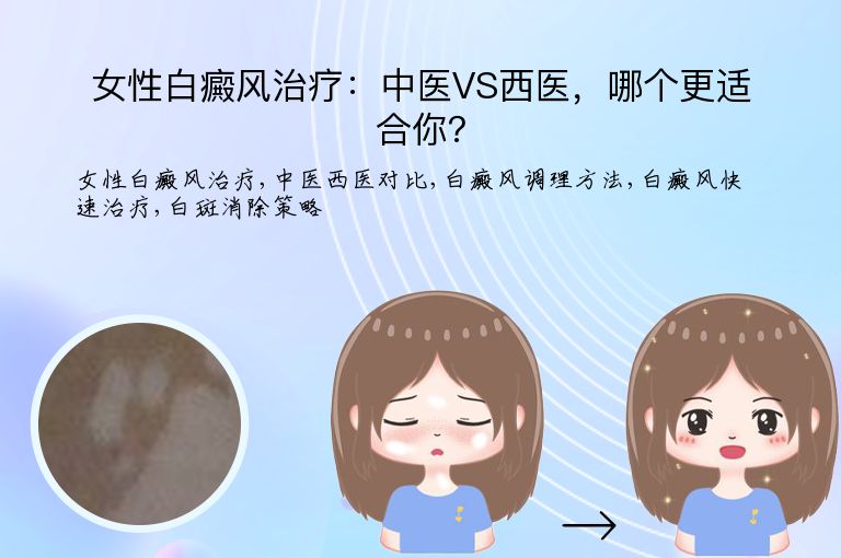 女性白癜风治疗：中医VS西医，哪个更适合你？”