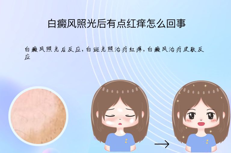 白癜风照光后有点红痒怎么回事”