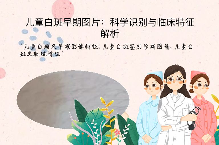 儿童白斑早期图片：科学识别与临床特征解析