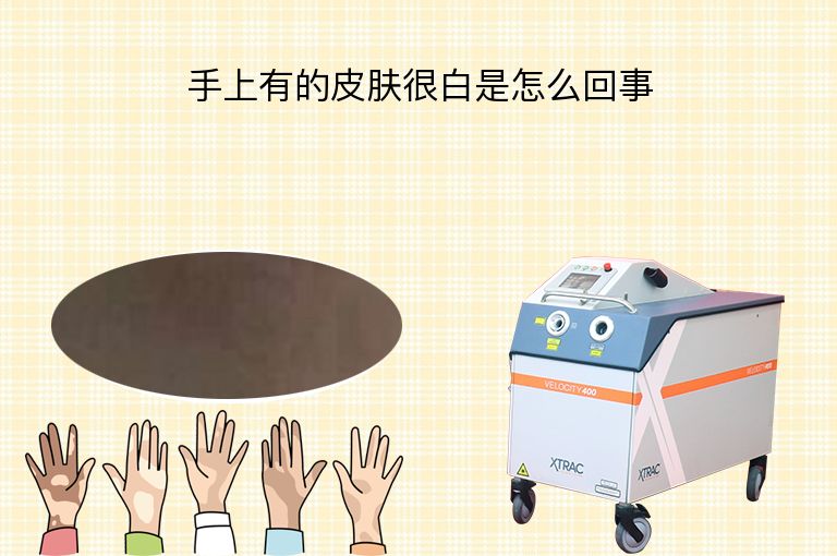 https://www.bdfsjzyy.com/d/file/p/9716029a3e2f90c0fa94d9feac2c4935.jpeg