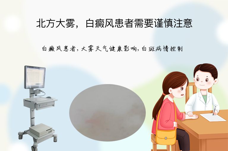 https://www.bdfsjzyy.com/d/file/p/ade40682c0eb8d694d301174fcb9da18.jpeg
