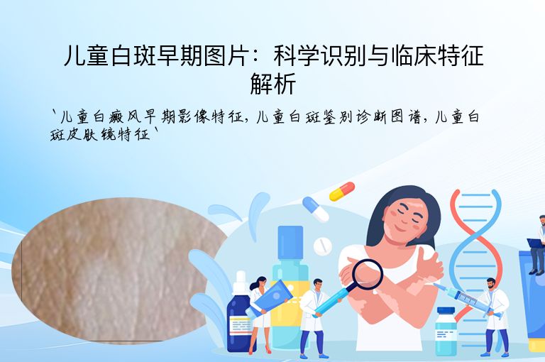 儿童白斑早期图片：科学识别与临床特征解析