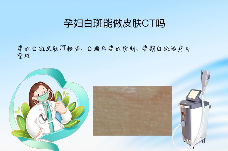 孕妇白斑能做皮肤CT吗”