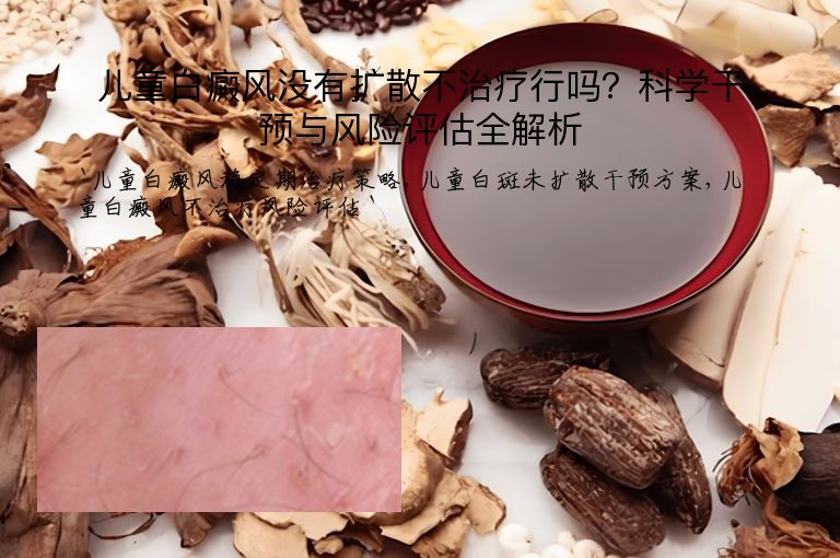 儿童白癜风没有扩散不治疗行吗?科学干预与风险评估全解析