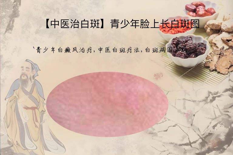 【中医治白斑】青少年脸上长白斑图”