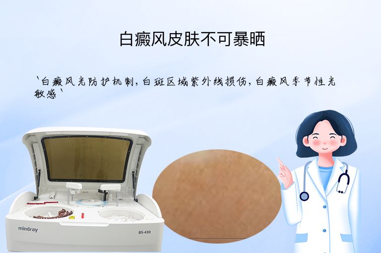 白癜风皮肤不可暴晒