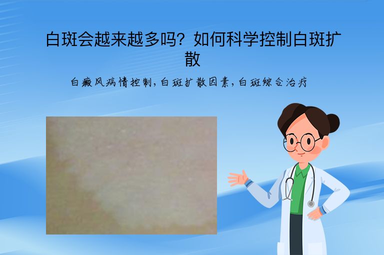 https://www.bdfsjzyy.com/d/file/p/a9d90c3faa3452f1617710b931cccedd.jpeg