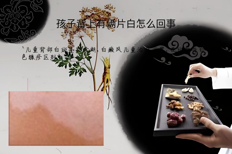 孩子背上有俩片白怎么回事