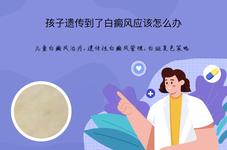 孩子遗传到了白癜风应该怎么办”