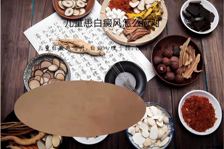 儿童患白癜风怎么应对”