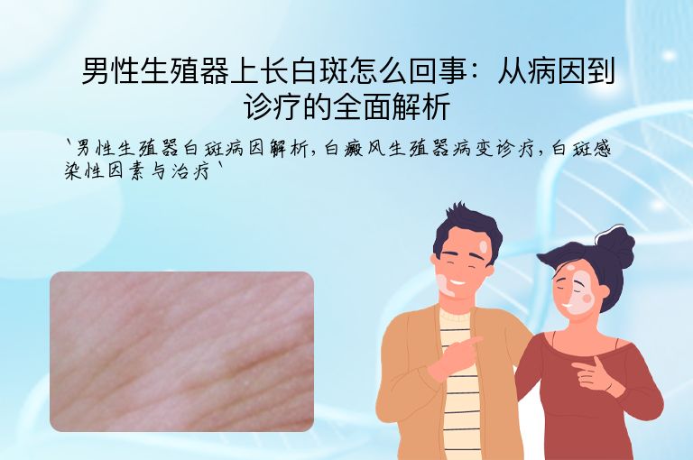 男性生殖器上长白斑怎么回事:从病因到诊疗的全面解析