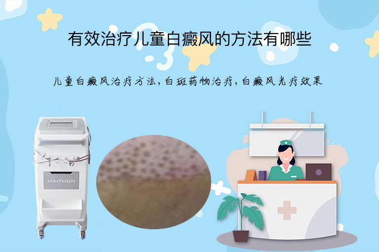 有效治疗儿童白癜风的方法有哪些”