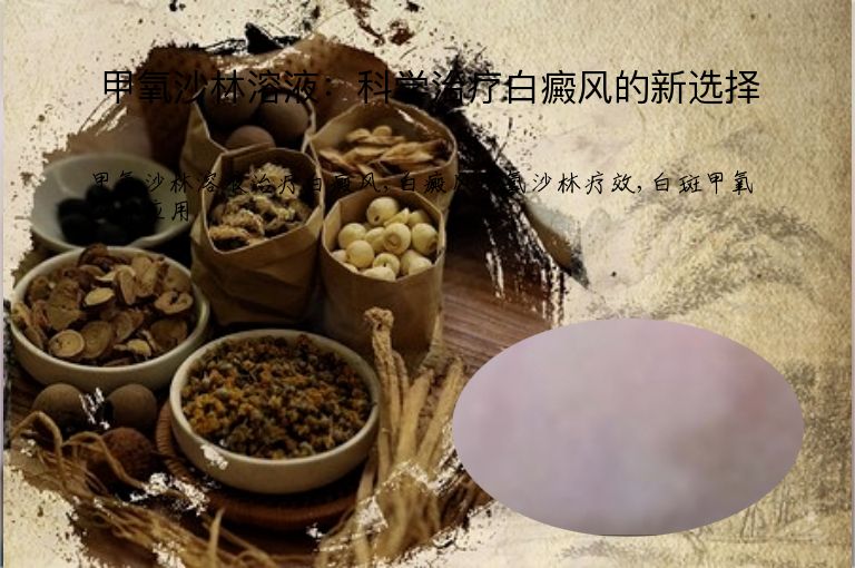 甲氧沙林溶液:科学治疗白癜风的新选择”
