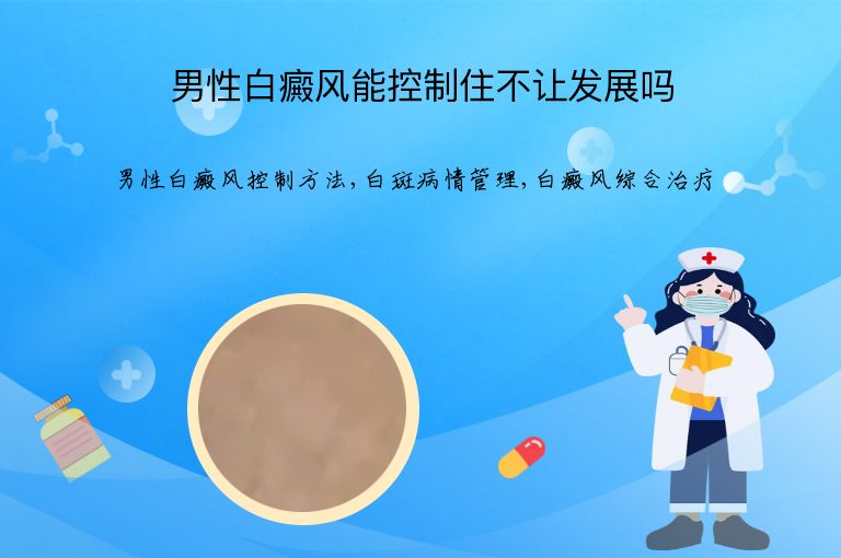 男性白癜风能控制住不让发展吗”
